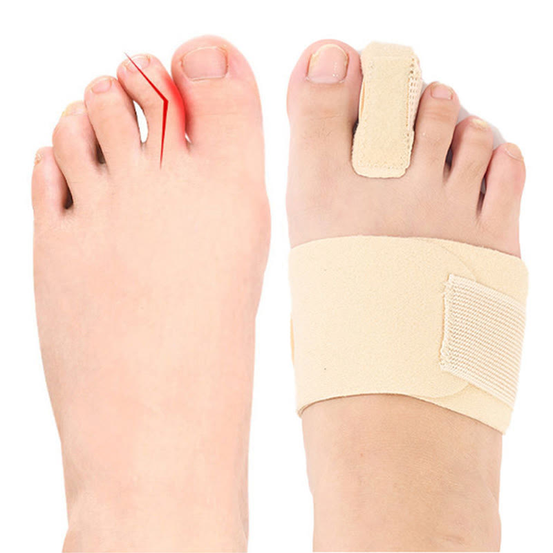 Aluminum Splint Toe Corrector(2 Packs) - image 3
